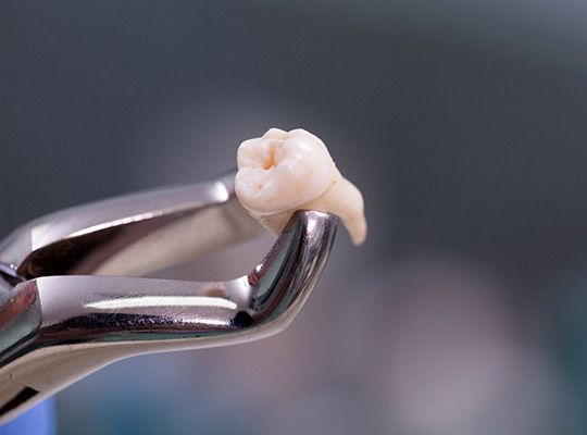 Closeup of dental tool holding extracted tooth