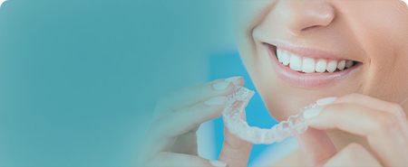 Invisalign special coupon
