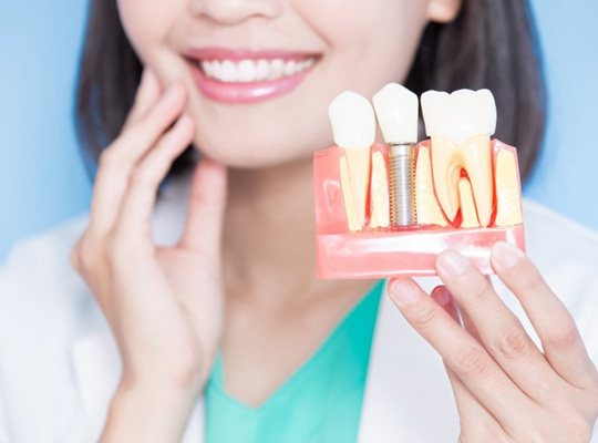 a person holding a model of a dental implant