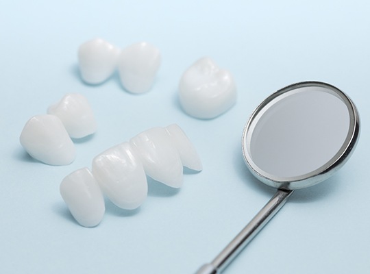 A variety of ceramic dental restorations