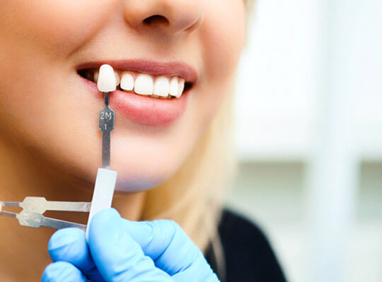 dentist holding color card to womens teeth