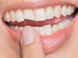 Woman receiving dental treatment