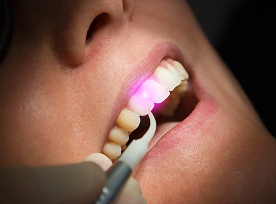 Patient receiving hard tissue laser dentistry treatment