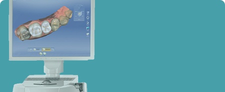 Digital model of the teeth on computer screen