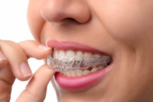 Woman putting clear aligner in her mouth. 