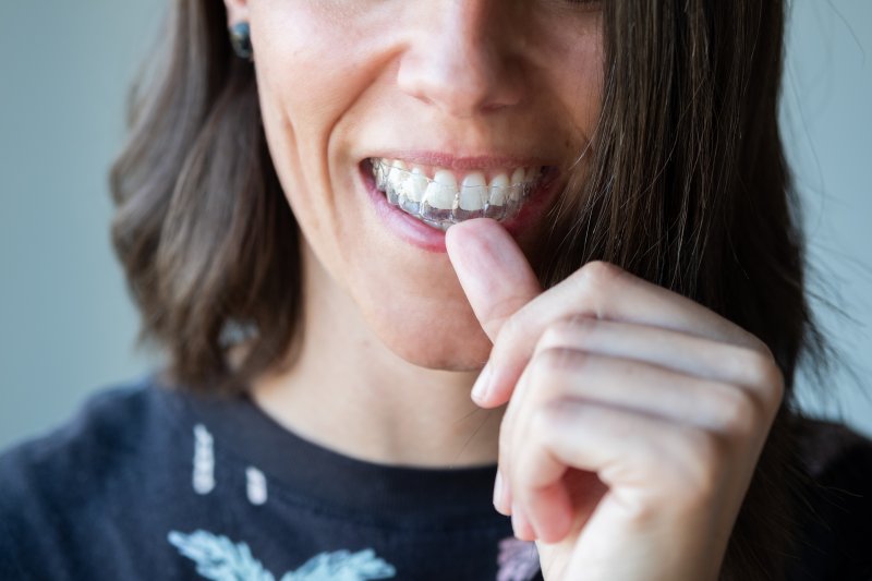 person putting on Invisalign aligner tray 